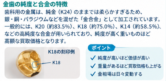 金歯の買取価格ガイド1-1