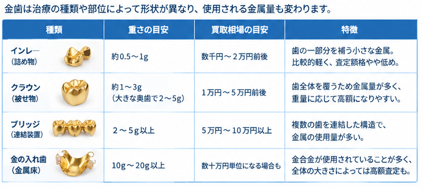 金歯の買取価格ガイド1-2
