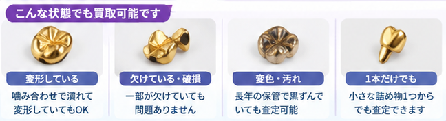 金歯の買取価格ガイド1-4