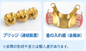 金歯の買取価格ガイド2-2